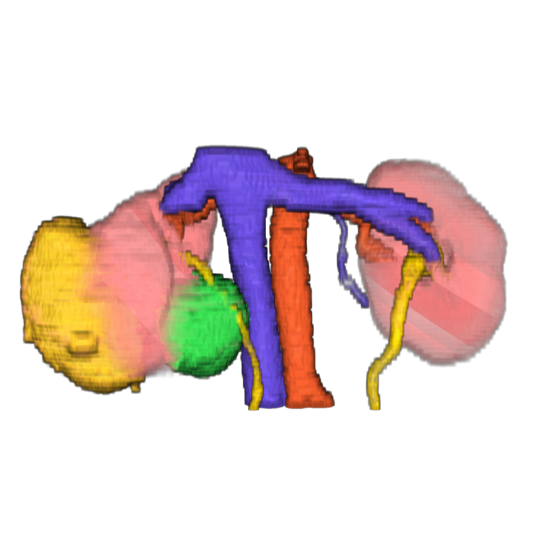 Segmentierung der Nieren mit Tumor, Zysten und Blutbahnen