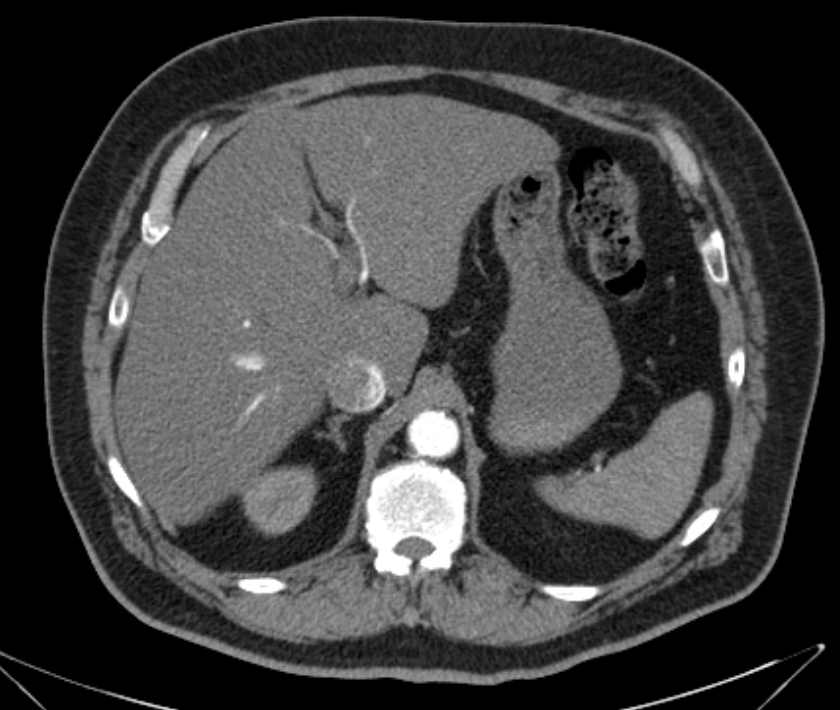 CT Scan der Kits19 Challenge